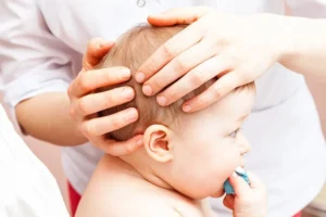 Flat Head Syndrome In Newborns